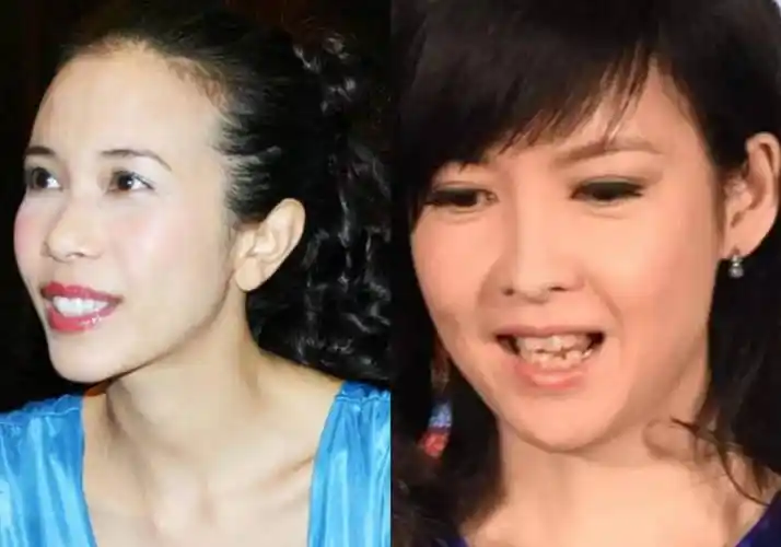 却被牙齿拉胯,这15位女星苦不堪言_周海媚_李冰冰_范冰冰