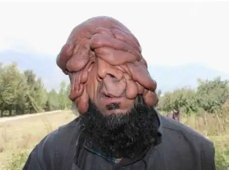 最恶心的图片集合世界上又丑又恶心的男人和女人