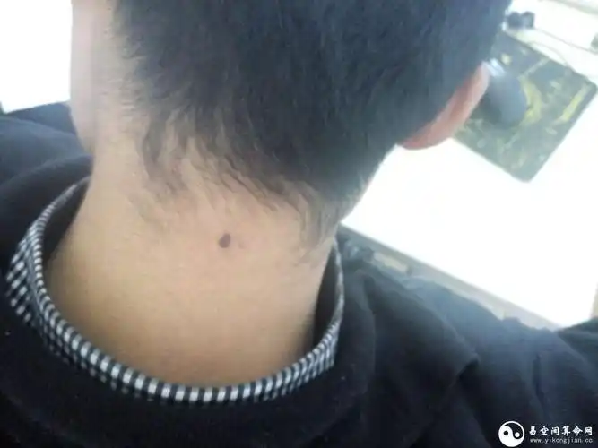 脖子上有痣的男人代表什么脖颈上右侧有长痣代表什么