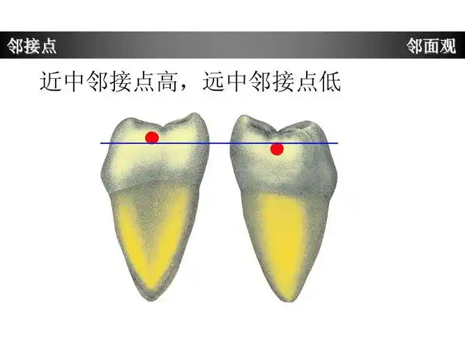 下颌第一磨牙牙体形态简述ppt