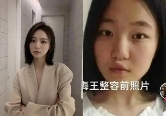 网红项思醒旧照曝光判若两人果然高端玩家都是从整容开始