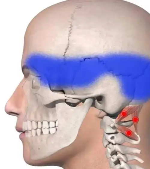 原创他有颈椎病头痛像戴着紧箍咒一个老头教他头画凤凰