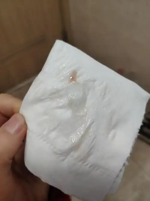 白带带血什么情况?