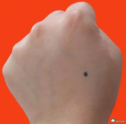 我左手手背上有颗痣是什么意思?