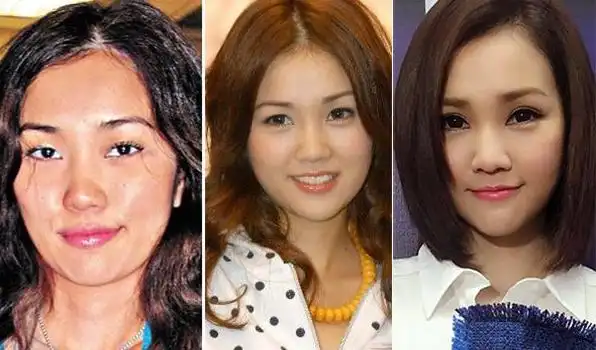 【香港整容失败老明星】_香港整容失败的女星_香港女星整容失败案例6