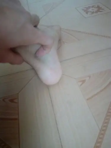 左脚脚腕脚尖向下为什么会痛,后脚跟那条筋痛,之前不知道怎么弄的