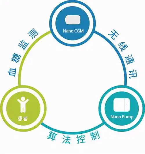 移宇科技全自动闭环人工胰腺上市,开启糖尿病管理新纪元