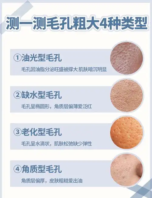 油性皮肤毛孔粗大?5步教你改善!