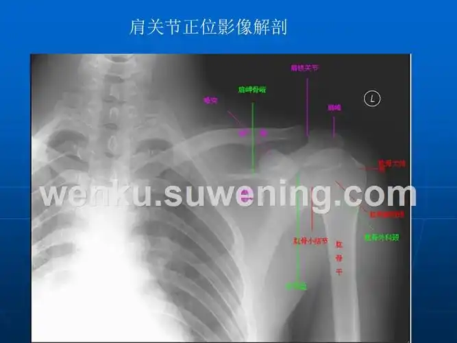 肩关节的摄影体位