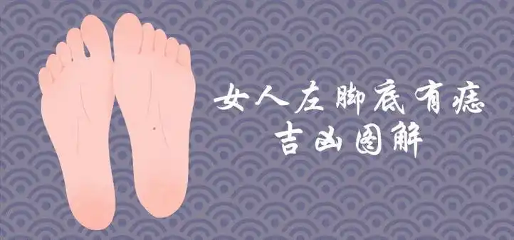 女人左脚底有痣全图解吉凶介绍
