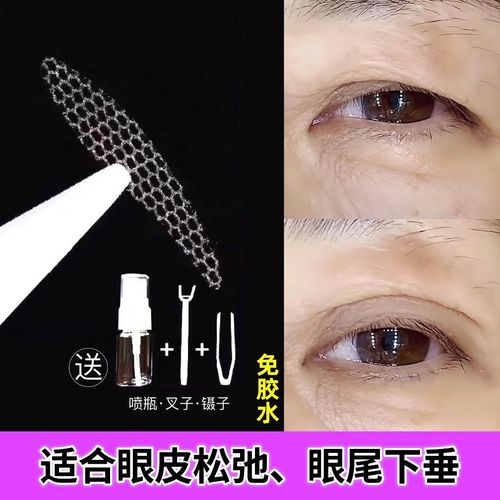 防眼垂双眼皮贴蕾丝隐形遇水即粘无痕矫正眼下垂40-60岁
