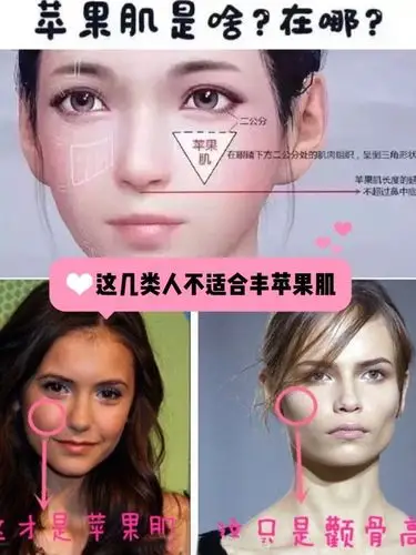 注意60这566类人不适合填充苹果肌60