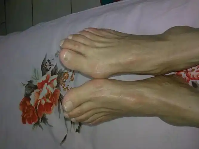 我妈妈的中脚趾头疼,是怎么回事啊?