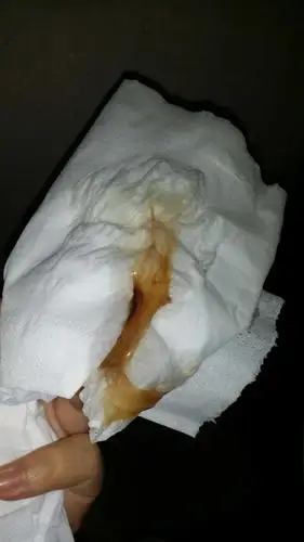 有宝妈见红是这个样子的吗?进来的送花(有图慎入,不喜勿喷)