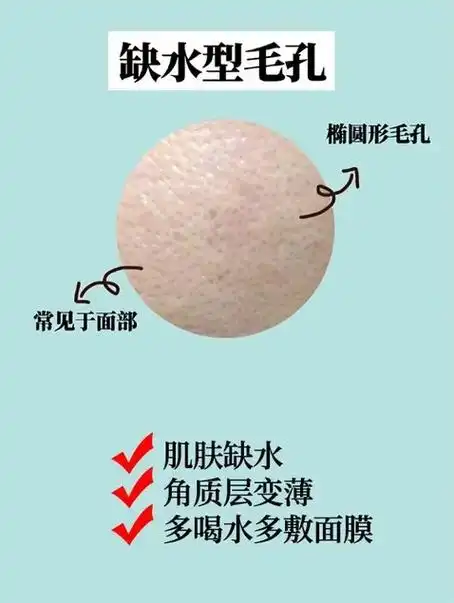 面部毛孔粗大的四种类型!看看你是哪一种.