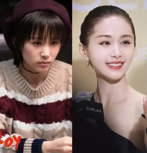 王子文深陷整容风波,前后判若两人