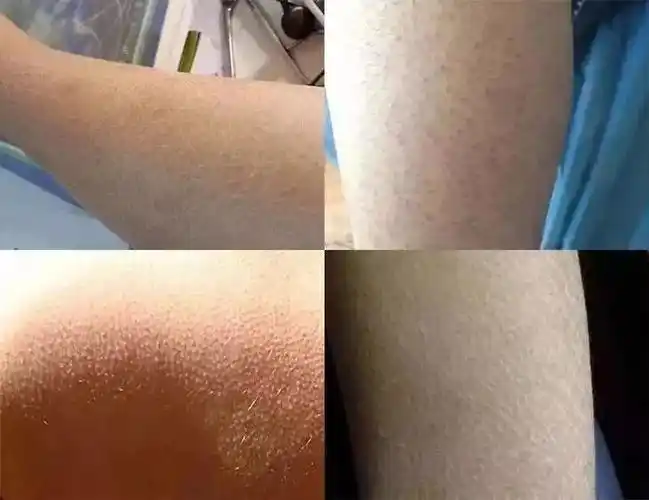 脸部体现不出女人的年纪和生活,但是 身体却是最容易暴露年纪的部位