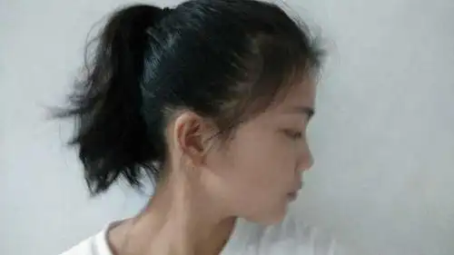 添加评论 分享 收藏 感谢          2 人赞同了该回答 头扁方脸塌鼻梁