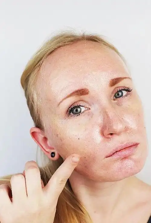 确定你是混合性皮肤. 下面给大家介绍一下混合性皮肤的特点.