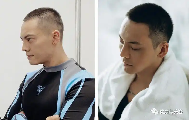 李易峰陈星旭剪寸头难看的m型发际线如何避免