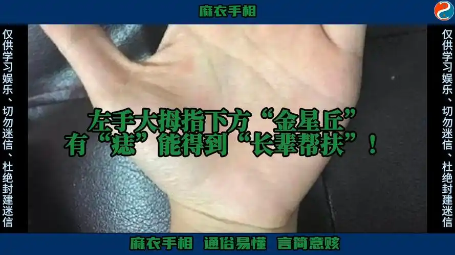 左手大拇指下方"金星丘"有"痣"能得到"长辈帮扶"!