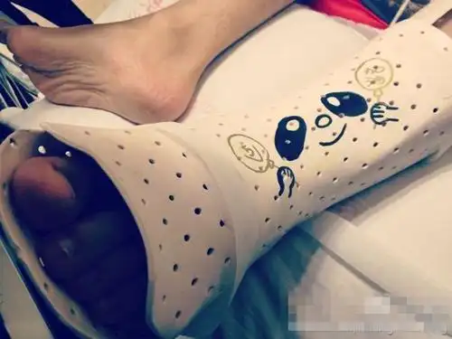 黄晓明植入4根钢钉2根钢针否被被截肢传闻组图