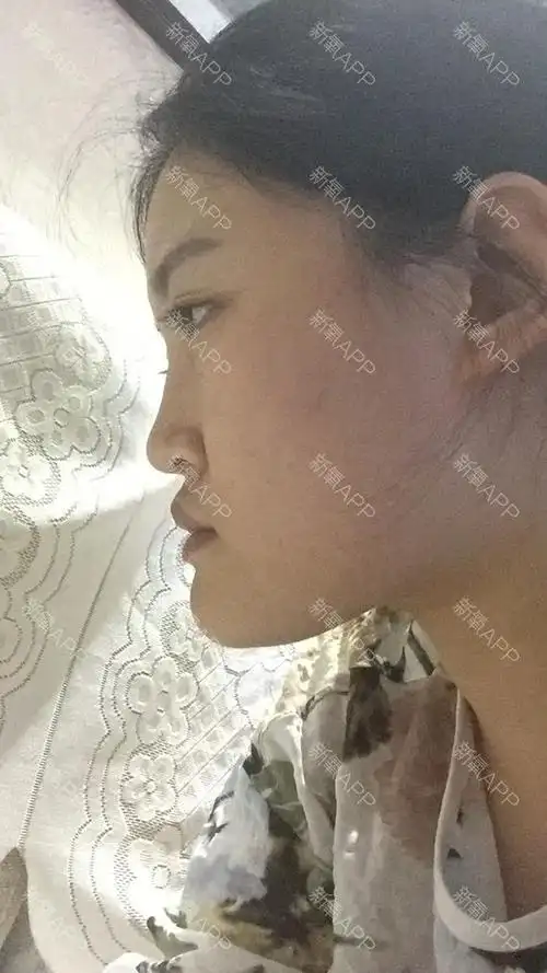 感觉自己侧脸像个月亮,侧脸很难看,下巴长,整个脸感觉很嫌老