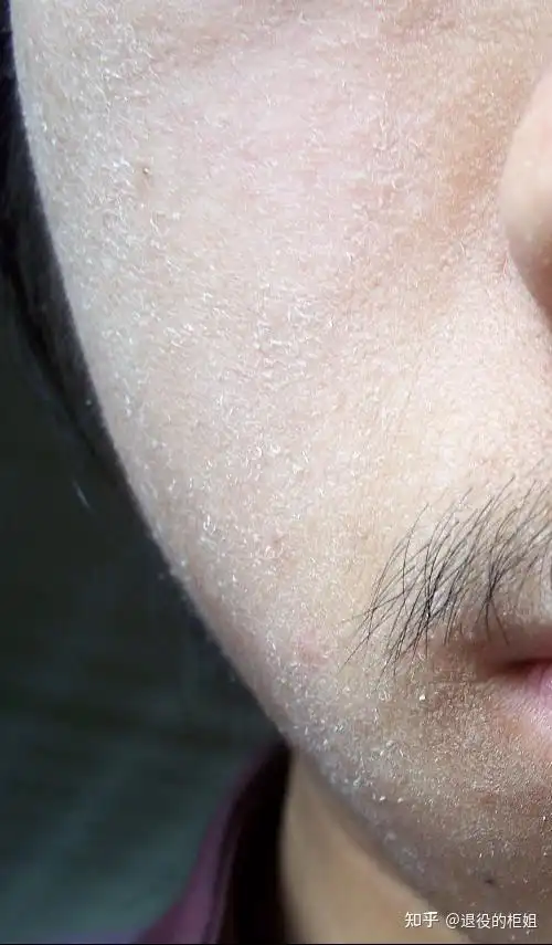 该如何正确处理?