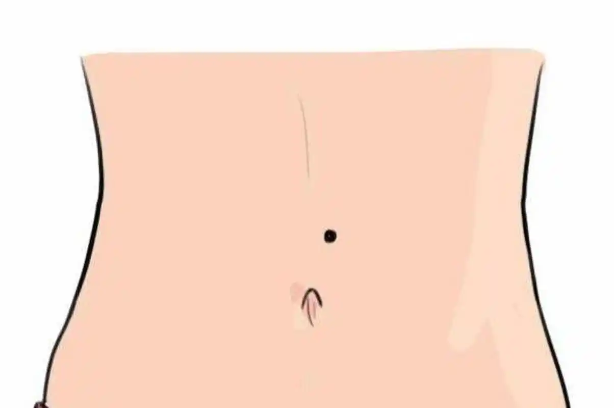 女生肚子有痣代表了什么?
