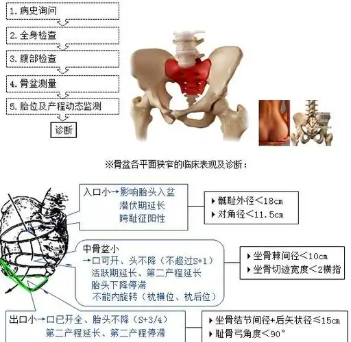 一,骨产道异常二,软产道异常一,骨产道异常---产道异常