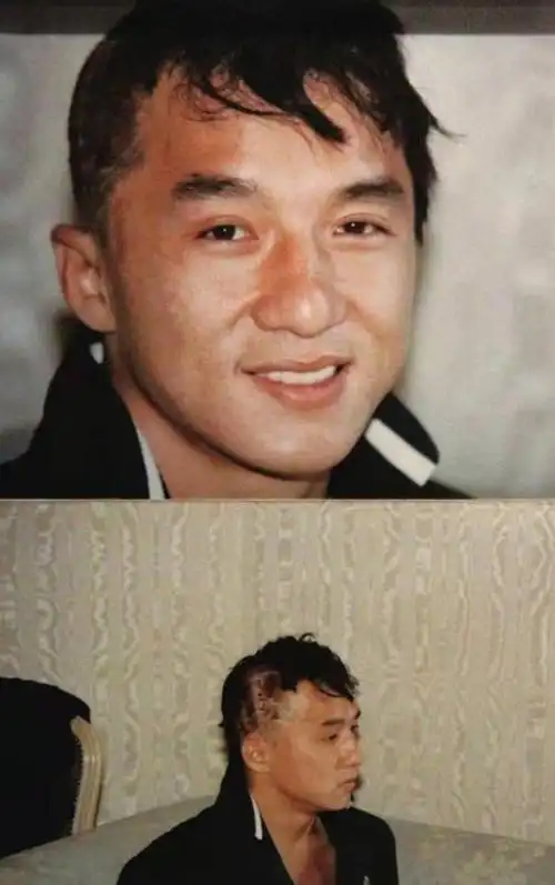 30张活久见照片:一张图了解成龙全身的伤痛?