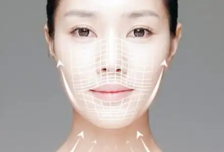 郑州微拉美埋线提升|微拉美全面部精雕 美丽从提拉开始 (返还童颜不是