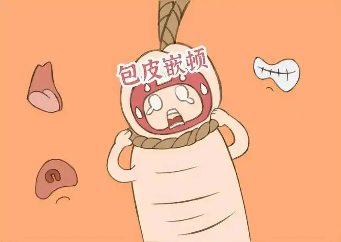 孩子啥时候割包皮,注意事项有哪些?