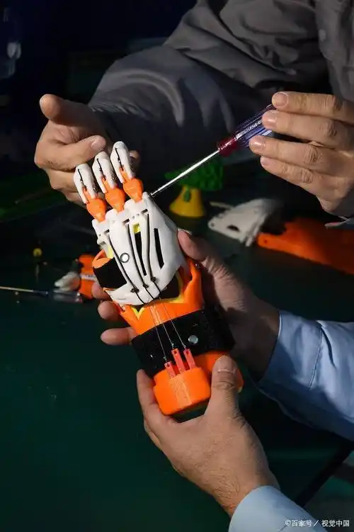 因左手缺失造成生活不便,故有安装假肢的想法,经与某司沟通,某司愿意