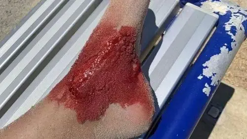 血腥慎入!珀斯少女在cottesloe海滩惨遭鲨鱼袭击!