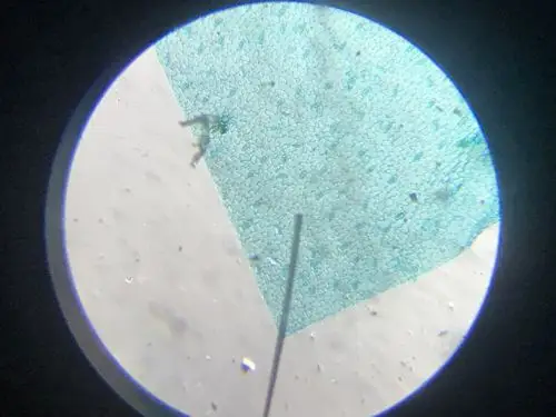 (32)微观世界/蚕豆叶