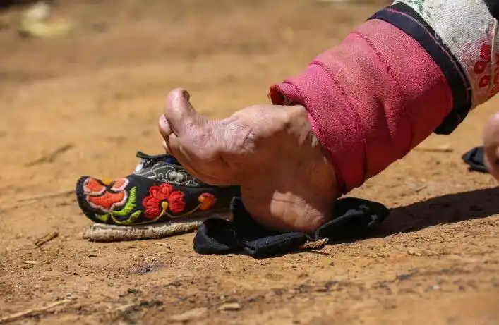 错误的审美观,揭露"三寸金莲"的秘密,见证一段屈辱的历史