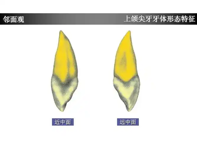 上颌尖牙牙体形态简述ppt