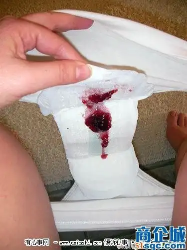 (图)   男人们,请你试着铺一束湿卫生纸在你裤裆间连续5~7天;而且,请