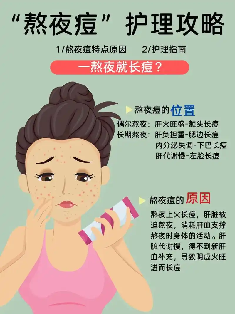 熬夜就长痘05熬夜痘护理指南73饮食护肤.