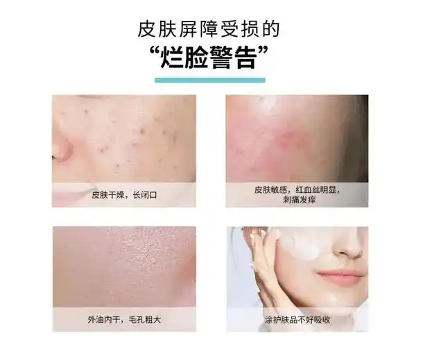 皮肤屏障受损角质层薄怎么修复皮肤屏障受损角质层薄怎么修复要多久