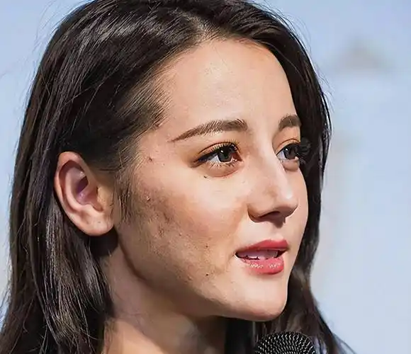 还有关节发黑的现象,这些普通女生会出现的问题,在女明星身上,同样