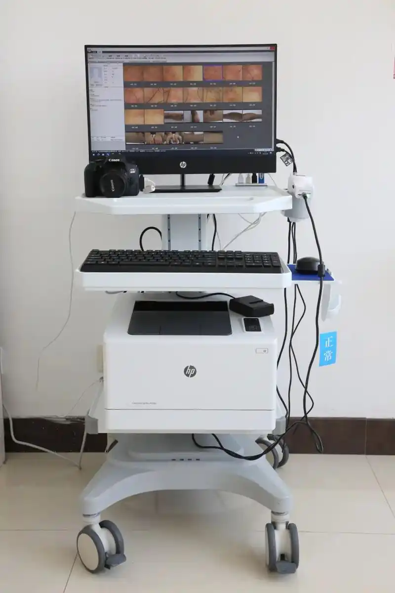 新技术新服务新能力皮肤镜皮肤科医生的透视眼