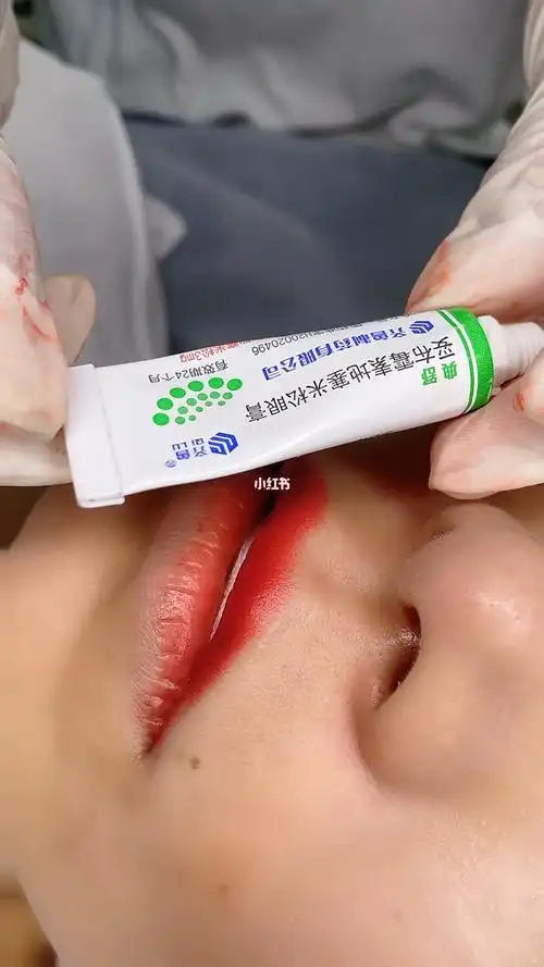 妥布霉素地塞米松眼膏消肿_消肿_半永久_美妆_医美整形