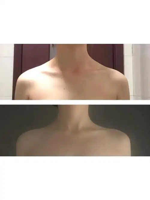 给大家分享一组消除斜方肌的运动简单有效