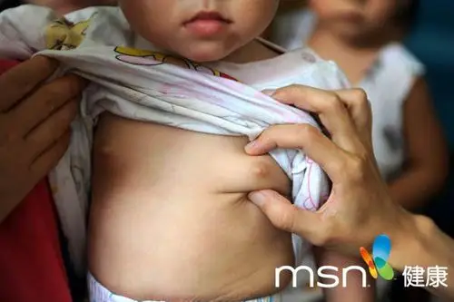 添加剂最多零食排行榜