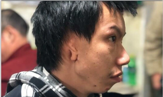 恋爱3天就被甩被人嘲笑不敢出门29岁无耳小伙我想要一对耳朵