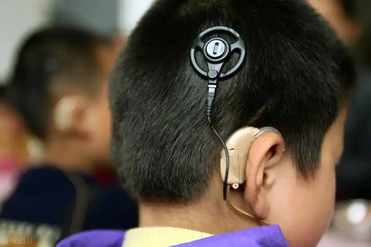 怎么辨别婴儿是聋哑儿(世界聋人日) - 乐宝宝贝