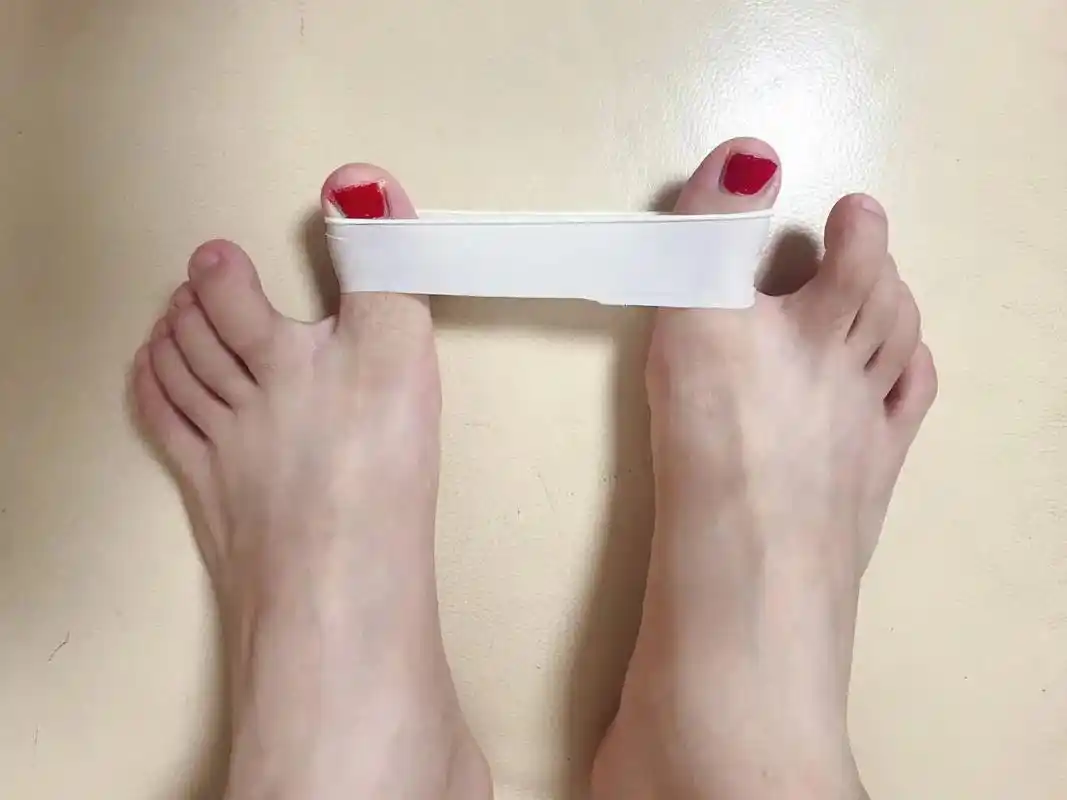 脚趾外翻怎么治疗最好最快(大脚趾长歪了,怎么办?拇外翻应该如何改善?