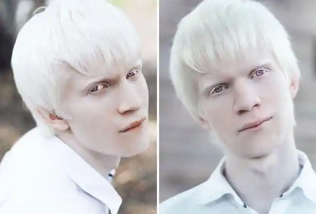 别样之美 欣赏一下这组白化病人的唯美写真